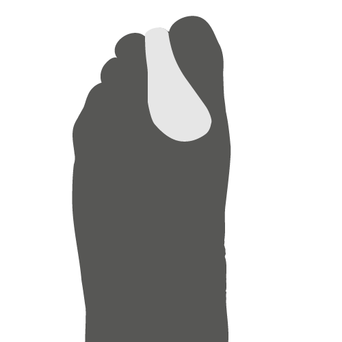 Orthoplastie